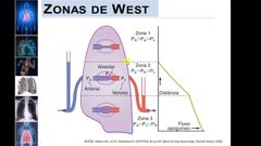 Zona 1 (vértice pulmonar): Menor irrigación
Zona 2: Irrigación pulsátil que aumenta en la sistole
Zona 3 (base pulmonar): Mayor irrigación
