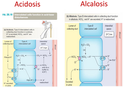 Acidosis: