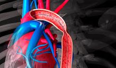 disminución de la luz de la aorta por proliferación (+ estrecha por debajo del origen la arteria subclavia). 3.2/10,000. Se puede presenciar en el sindroma de Turner. Hay 2 tipos: preductal(antes del conducto) y postductal (después del conducto...