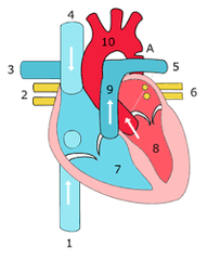 Obliteración del 4° arco aórtico