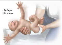 2- Del Moro
ESTIMULO - Se desencadena al dejar caer la 
cabeza del bebe en las manos 
del examinador, manteniendo al
bebe sentado con el tronco
inclinado hacia atrás
REACCION - Consta de tres etapas: 
1. abducción de las 
extremidades (es decir ...