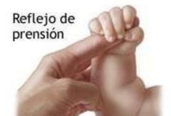 3- Prensión palmar
ESTIMULO- Se desencadena estimulando la 
palma de la mano con un objeto
o la mano del examinador
REACCION - El bebe flexiona 
instantáneamente los sobre el 
objeto , cerrando la mano ante 
cualquier estimulo.
EDAD MAX - 2-3 meses