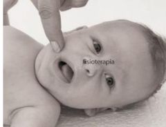 6-  De búsqueda
ESTIMULO- Se roza la zona perioral del bebe 
con las manos (las comisuras)
REACCION - El bebe buscara la fuente del 
estímulo pensando que es la 
**** de su madre, girara su 
cabeza hacia donde provenga el 
roce 
EDAD MAX - 5-7 m...