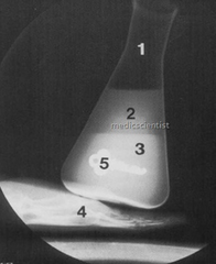 El número 4, ¿qué representa en la siguiente radiografía?