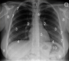 ¿Qué parte representa el número 4 de la siguiente Radiografía?
