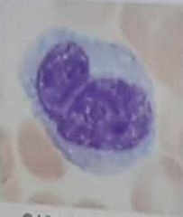 account for 4-8% pf leukocytes
-largest WBCs
-abundant pale blue cytoplasm
-purple staining, U or Kidney shaped nuclei
-siya yung kumakain ng bacteria

