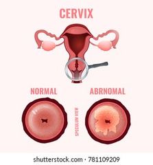 Casi cierra el extremo inferior del útero; sostiene el embrión en desarrollo durante el embarazo.