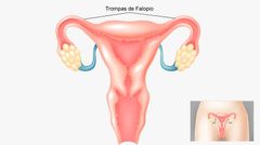 Trompas uterinas