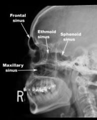 (X-ray of skull in saggital section)