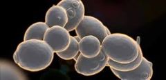 -  Hongos microscópicos 
-  Levaduras- Se forma una yema que se contrae, formando una nueva célula por gemación 
-  Hifa- Forma tubular, con o sin tabique 
-  Red de hifas- Moho, forma de "cabeza de medusa"
