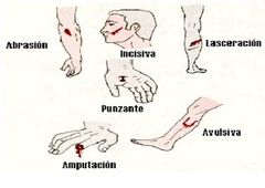 Lesiones por instrumentos cortantes