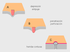 Lesiones por proyectil de arma de fuego