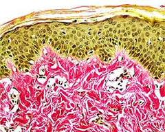Tiñe el colágeno de un color rosado-rojo y el músculo de amarillo.  Las fibras elásticas se tiñen de negr-marrón.

Sirve para diferenciar las fibras más comunes de las células de sostén.
