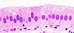 Sus células superficiales tienen forma cilíndrica
Sus células mas profundas se asemejan al epitelio plano estratificado