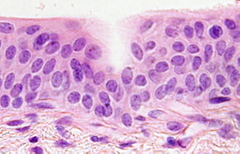 Las capas mas basales tienen forma cubica o Cilíndrica 
Se encuentran solo en las vías urinarias excretoras pudiéndose denominar urotelio