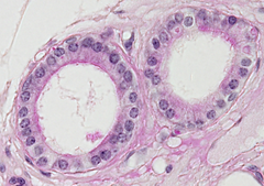Son casi cuadradas, con un núcleo esférico ubicado en el centro
Se encuentran en los canalí***** secretores de muchas glándulas, en los folí***** de la glándula tiroides, túbulos renales y superficie de ovarios.