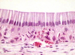 Son células columnares con núcleos ovalados que se ubican a la misma altura  cerca de la base
Se encuentra recubriendo la superficie interna del tubo digestivo y es característico de las glándulas.  El El que es ciliado se encuentra en el útero.