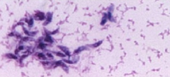 Name  protozoan
