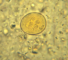Name protozoan and form