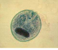 Name protozoan and form?