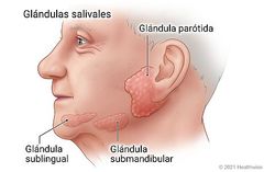 -G. Parotídeas : producen una secreción acuosa
desprovista de moco
-G. Sublinguales y submaxilares : formadas por
células mucosas y serosas y situadas por debajo de
la mucosa del suelo de la boca, en donde
desembocan por varios conductos.