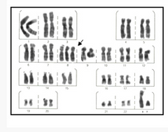 Organización de los cromosomas de acuerdo al tamaño y la localización del centrómero.