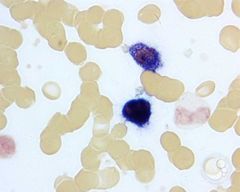 Hematology Stains Flashcards - Cram.com