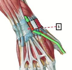 3.	Extensor largo del pulgar