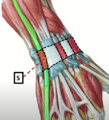 5.	Extensor propio del meñique