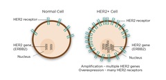 HER2 overexpression --> spontaneous dimerization --> cells enter cell cycle all the time = cancer