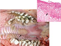 name this viral infectious disease of the oral cavity.