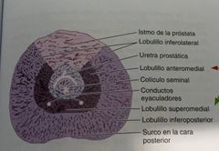 Es un lobulillo profundo e inferoposteior, directamente lateral a la uretra prostática proximal