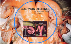 Cuernos uterinos