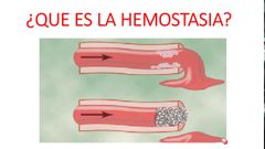 ¿Qué es la hemostasia?