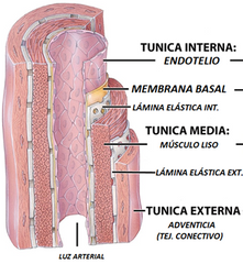 - Hablamos de una patología que se especializa por la formación de placas de ateroma en la TÚNICA INTIMA. 
- Afecta principalmente arterias de mediano y gran calibre, como las ARTERIAS CORONARIAS.