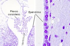 Células del epéndimo