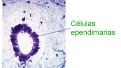 células del epéndimo