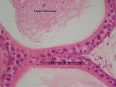 células del epidídimo