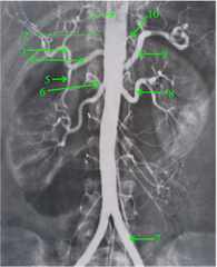 Idenitrify each of the following arterial structures.
