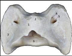 Atlas ovino vista dorsal.
1: Arco dorsal; 2: tubérculo 
dorsal; 3: Ala de atlas; 4: 
Agujero vertebral 5: 
Agujero alar; 6: Foramen 
articular caudal; 7: Fosita 
para el diente.