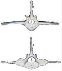 Vértebras lumbares 1: cuerpo vertebral; 2: 
Apófisis transversa; 3: Apófisis espinosa; 4: Cara 
articular; 5: Agujero vertebral.