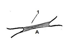 ¿Qué tipo de articulación fibrosa es?