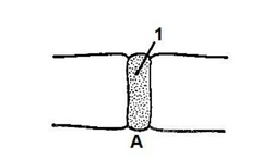 ¿Qué tipo de articulación cartilaginosa es?