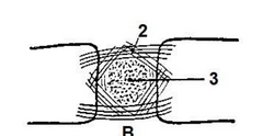 ¿Qué tipo de articulación cartilaginosa es?