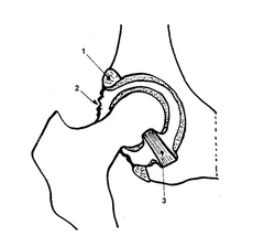 Articulación de la 
cadera
1. Labrum acetabular
2. Capsula articular
3. Ligamento de la 
cabeza del fémur