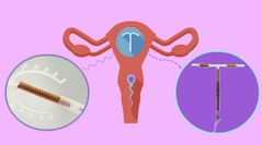 Función 

- Hacer que el moco alrededor del cérvix sea más grueso, lo que hace más difícil que el espermatozoide entre al útero y fertilice un óvulo.