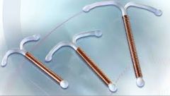 DIU que libera cobre:
Su función es inmediata después de insertado.
Su función se centra en eliminar iones, estos son tóxicos para los espermatozoides y su forma ayuda a bloquearlos y así evitar el paso hasta el ovulo.
