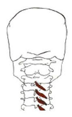 1.ORIGEN: Procesos transversales.

2.INSERCIÓN: Unión de la apófisis transversa y la lámina. Procesos espinosos.

3.ACCIÓN: Control postural.

4.INSERVACIÓN: Ramas dorsales de los nervios espinales cervicales
