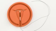 Para colocar el DIU, el enfermero o el médico introducen un espé**** en la vagina y después utilizan un colocador especial para introducir el DIU en el útero a través de la abertura del cuello uterino.