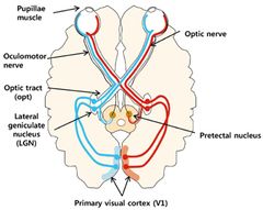 optic nerve -> lateral geniculate nucleus of the thalamus -> primary visual cortex in the occipital lobe 